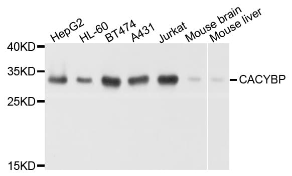CACYBP Antibody