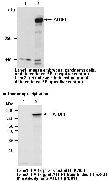 ZFHX3 / ATBF1 Antibody