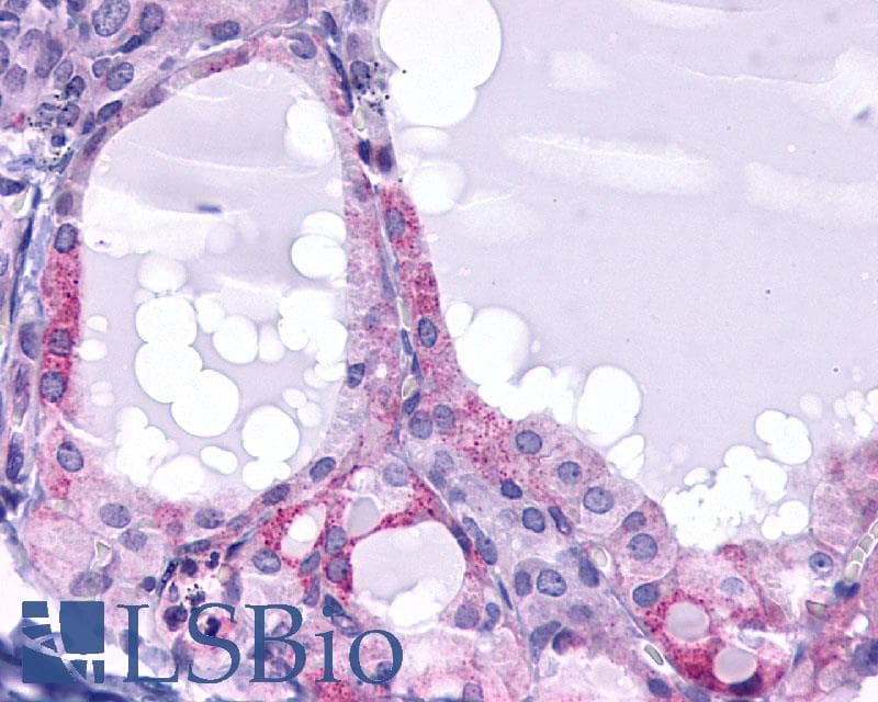 PathPlus™ TSH Receptor / TSHR Antibody (N-Terminus)