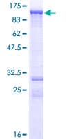 Human C-TAK1 / MARK3 Protein (Recombinant GST)