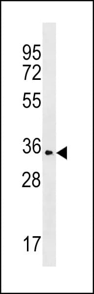 OR2T35 Antibody (aa296-323)