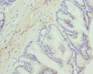 DGKA Antibody
