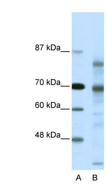 NCOR2 / SMRT Antibody (aa511-560, FITC)