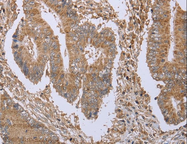 SLIM / FHL1 Antibody