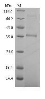 Streptomyces viridochromogenes Phosphinothricin N-acetyltransferase Protein (Recombinant 6His-SUMO, N-terminus)