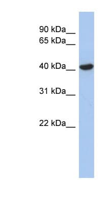 Polyclonal Rabbit anti-Human ZFYVE1 / DFCP1 Antibody (aa35-84, WB)