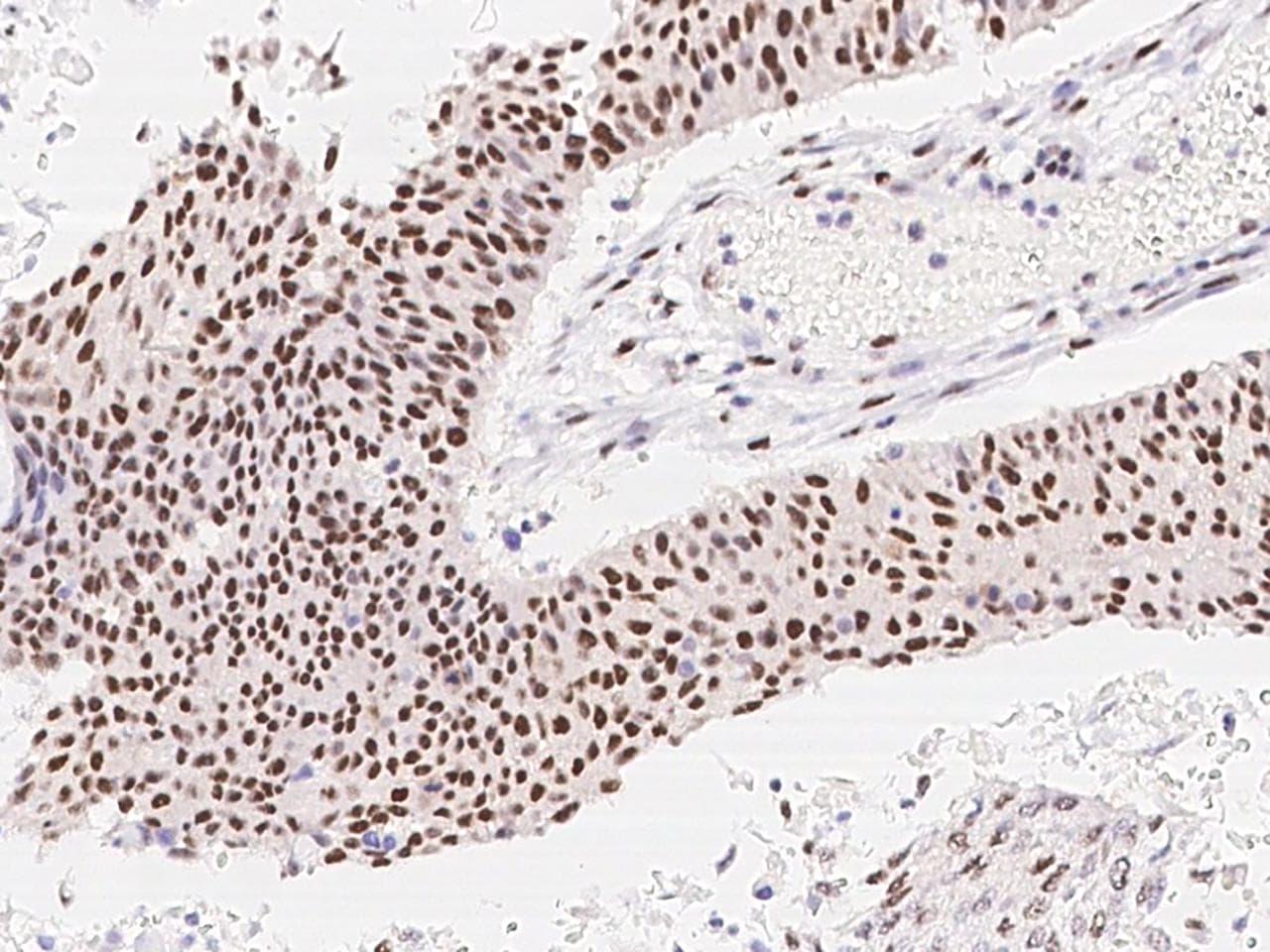 Polyclonal Rabbit anti-Human DAPK3 / ZIP Kinase Antibody (Preservative Free, IHC, IF)