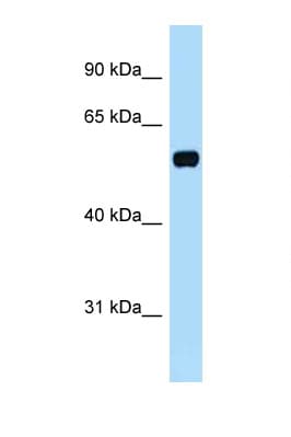TOM1L1 Antibody (aa276-325)