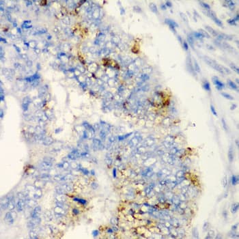 TIRAP Antibody