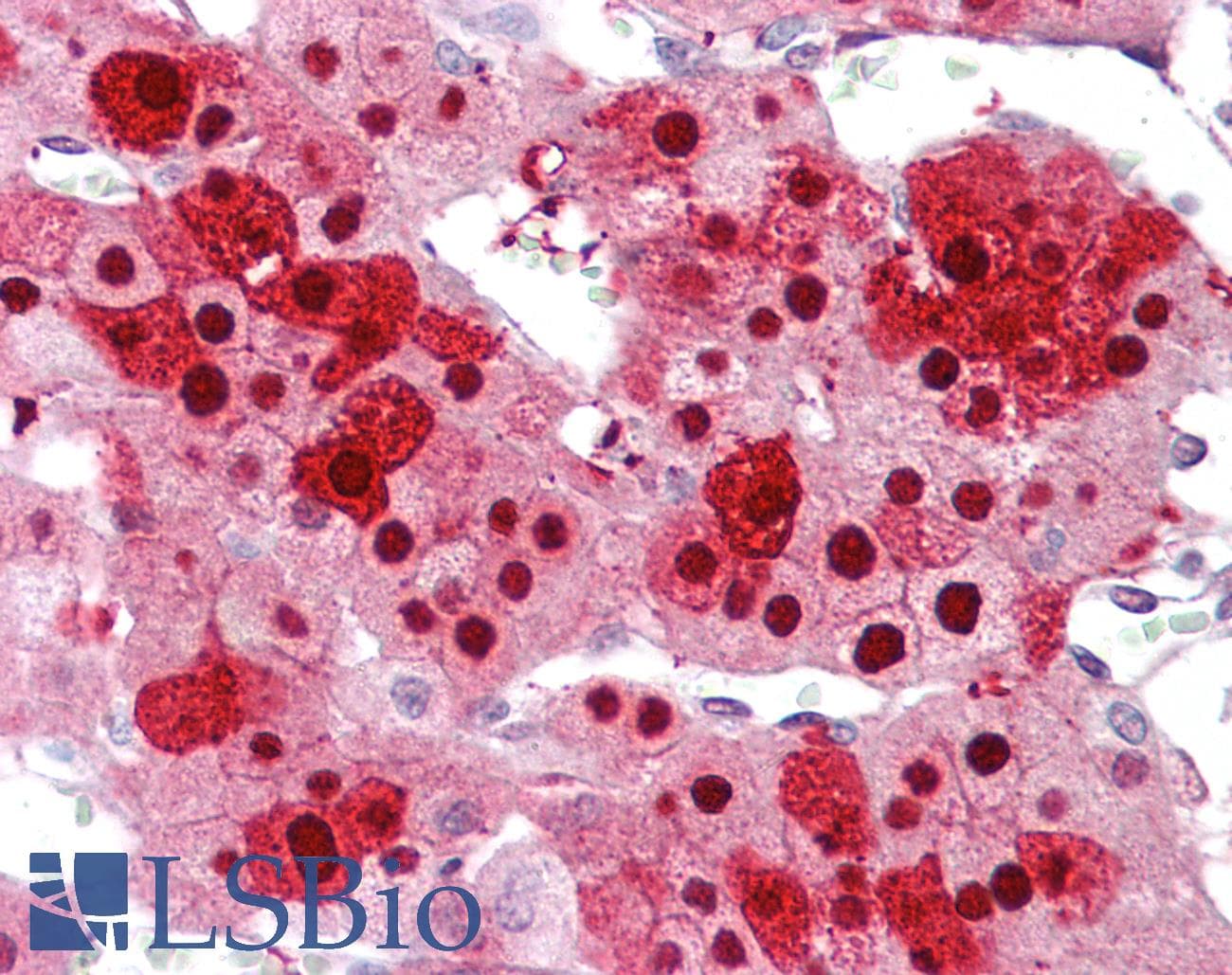 IHC-plus™ Polyclonal Rabbit anti-Human ZNF346 Antibody (IHC, WB)