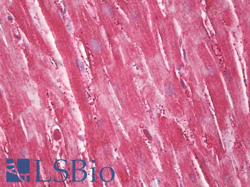IHC-plus™ CKM / Creatine Kinase MM Antibody (aa10-59)