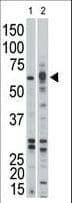 Polyclonal Rabbit anti-Human ACVR1B / ALK4 Antibody (aa134-164, WB)