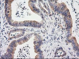 Monoclonal Mouse anti-Human EIF4E2 / IF4e Antibody (clone OTI1C1, IHC, WB)