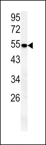 Polyclonal Rabbit anti-Human SLC43A2 Antibody (aa236-265, WB)