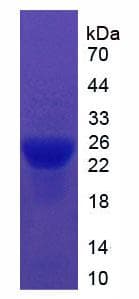 Mouse ITIH5 Protein (Recombinant His)