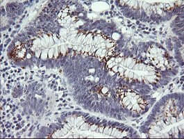 Monoclonal Mouse anti-Human IL1F9 Antibody (clone 2F4, Carrier-free, IHC, IF, WB)