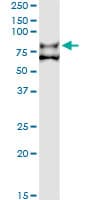 Monoclonal Mouse anti-Human F11 / FXI / Factor XI Antibody (clone 2H8, WB)
