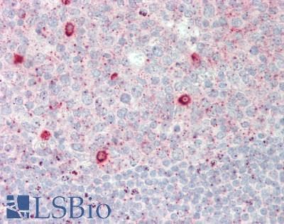 IHC-plus™ Polyclonal Rabbit anti-Human PLA2G3 Antibody (Internal, IHC, WB)
