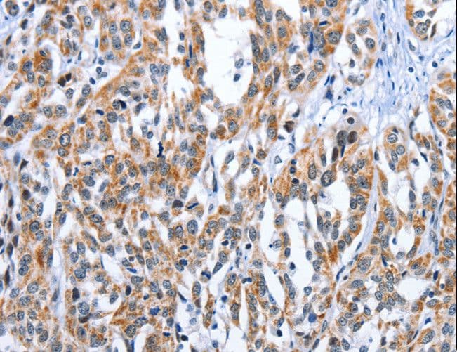 Endothelin 3 / EDN3 Antibody