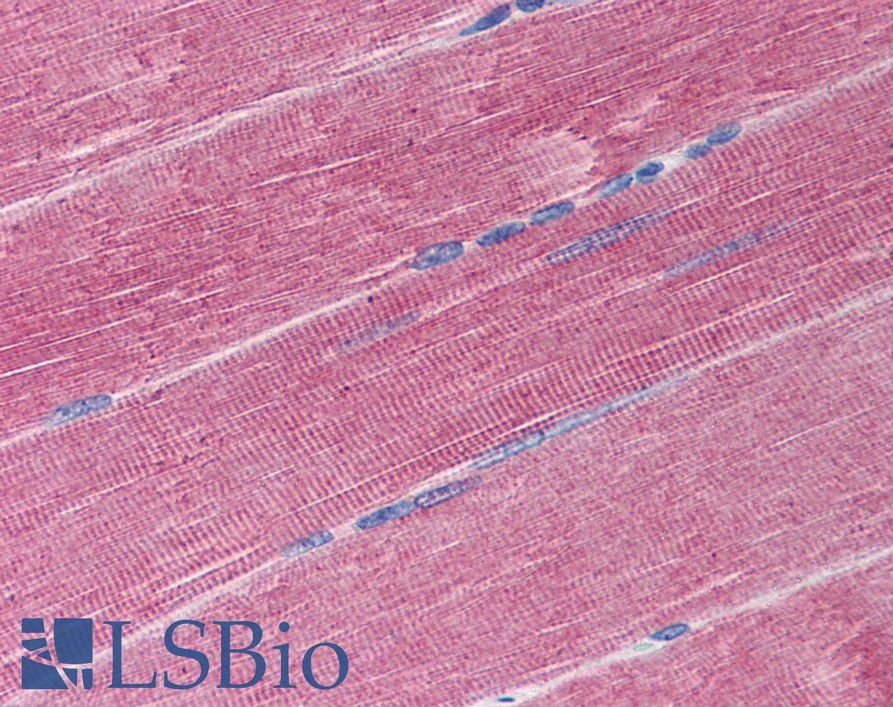 IHC-plus™ ADAM17 / TACE Antibody (C-Terminus)
