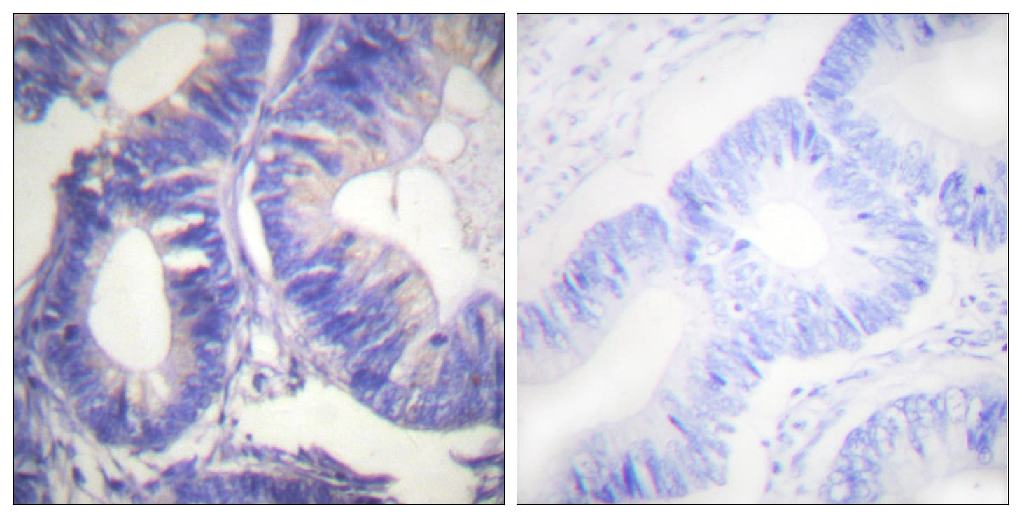 GRB4 / NCK2 Antibody (aa331-380)