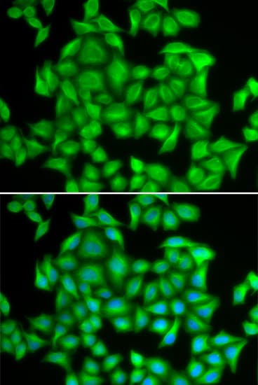 HNRNPA2B1 Antibody