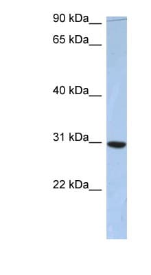 Polyclonal Rabbit anti-Human PDZD9 Antibody (aa73-122, WB)