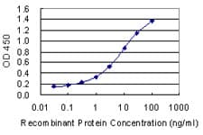 Monoclonal Mouse anti-Human FECH / Ferrochelatase Antibody (clone 3H3)