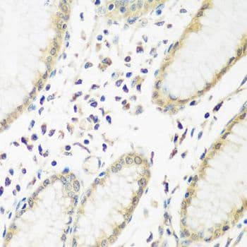 Polyclonal Rabbit anti-Human PYCR1 Antibody (IHC, WB)
