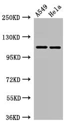 EPHA5 / EPH Receptor A5 Antibody