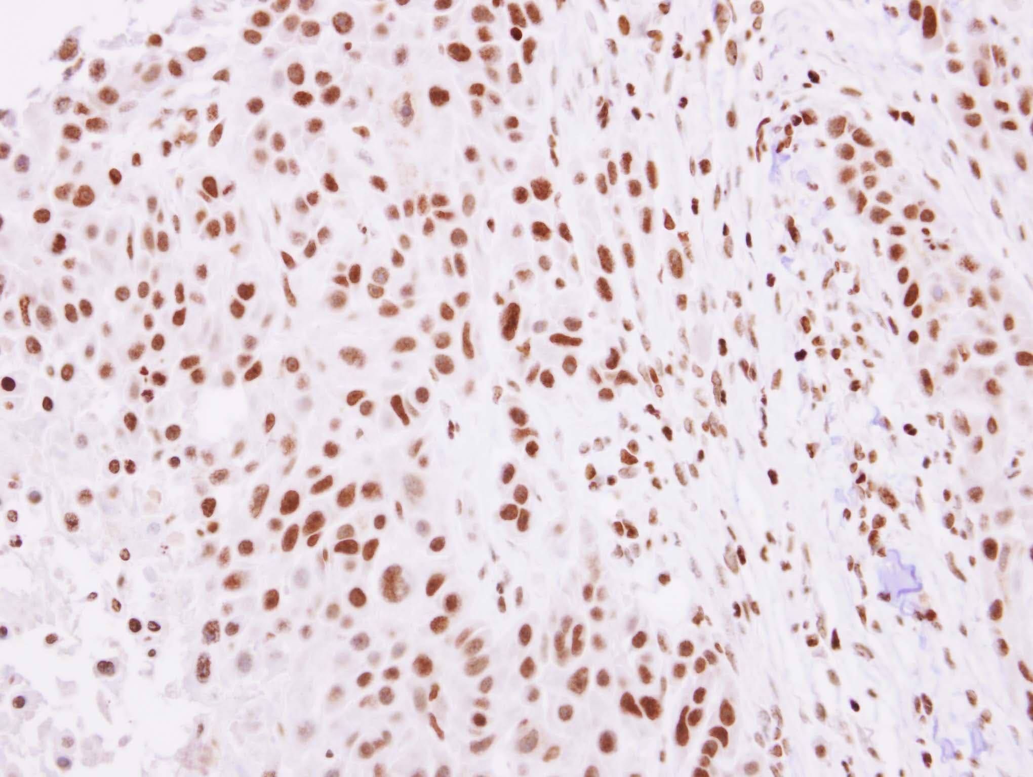 Polyclonal Rabbit anti-Human H2AFZ / H2A.z Antibody (IHC, IF, WB)