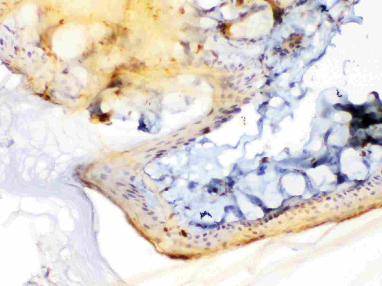 PPL / Periplakin Antibody