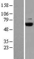 COASY Protein (Over-Expression Lysate Myc-DDK (Flag))