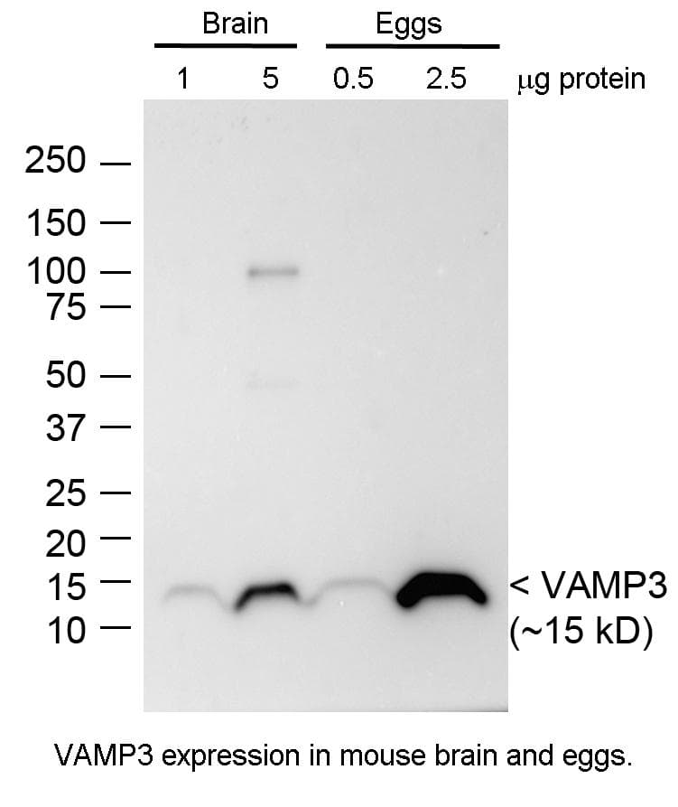 IHC-plus™ CYSLTR1 / CYSLT1 Antibody (Extracellular Domain)