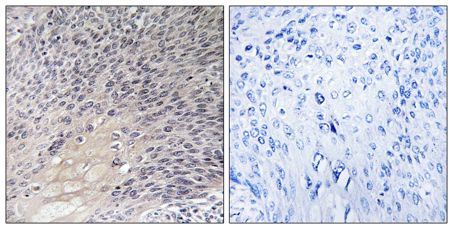 ARHGDIA / RHOGDI Antibody (aa140-189)