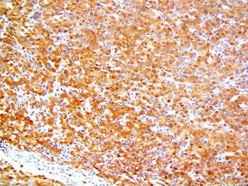 Recombinant Monoclonal Rabbit anti-Human SMAD4 Antibody (clone RBT-SMAD4, Ready-to-Use, IHC)
