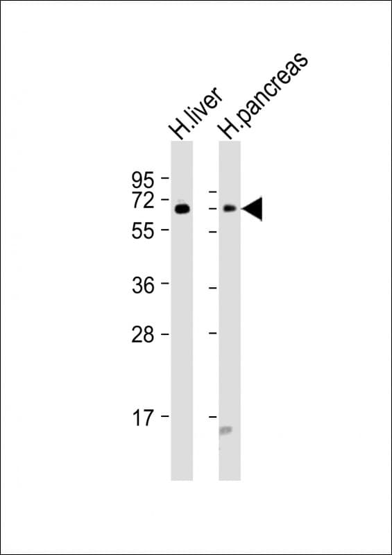 GCKR Antibody (aa40-72)