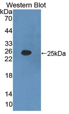 IFNA2 / Interferon Alpha 2 Antibody (aa24-192)