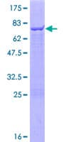 Human TRIM47 Protein (Recombinant GST)