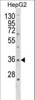 E2F5 Antibody (aa66-93)