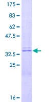 Human PTH / Parathyroid Hormone Protein (Recombinant GST)