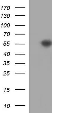 TUBB2A / Tubulin Beta 2A Antibody (clone OTI3B7)