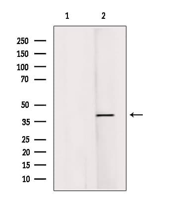Polyclonal Rabbit anti-Human RASSF1 / RASSF1A Antibody (IHC, WB)