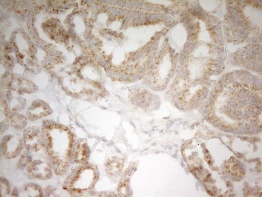 Monoclonal Mouse anti-Human PIK3R4 Antibody (clone OTI5D1, aa732-1036, IHC)