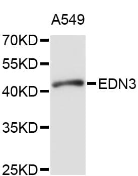 Endothelin 3 / EDN3 Antibody