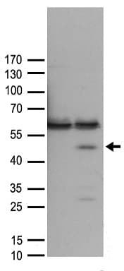 PHF9 / FANCL Antibody