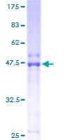 Human ORM1 / Orosomucoid Protein (Recombinant GST)