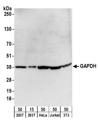 Polyclonal Rabbit anti-Human PSMD1 Antibody (aa903-953, IHC, WB)