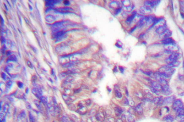 PRKACA + PRKACB Antibody (Val191)