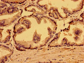 Polyclonal Rabbit anti-Human MARS2 Antibody (IHC, WB)
